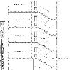 Reforma de edificio Ctra. de Jaca 10
